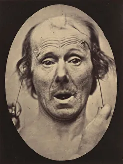 Adrien Tournachon Gallery: Figure 56: Surprise, 1854-56, printed 1862. Creators: Duchenne de Boulogne