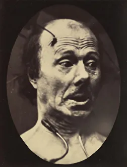 Adrien Tournachon Gallery: Figure 60: Fright, 1854-56, printed 1862. Creators: Duchenne de Boulogne
