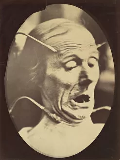 Terror Gallery: Figure 62: Terror, semiprofile, 1854-56, printed 1862. Creators: Duchenne de Boulogne