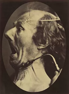 Boulogne Gallery: Figure 63: Expression of terror, 1854-56, printed 1862. Creators: Duchenne de Boulogne