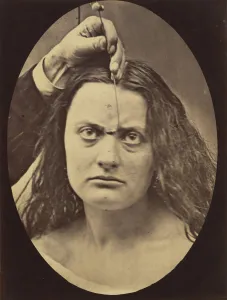 Duchenne Prints: Figure 82: Lady Macbeth, strong expression of cruelty, 1854-56, printed 1862