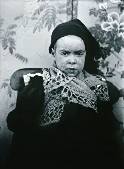 Gloucester smallpox epidemic, 1896: a child of the Beard family, as a convalescent smallpox... 1896 Creators: HCF of Gloucester, Unknown