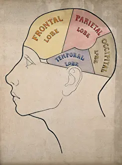 Section Prints: Head of a backward boy divided into four cerebral lobes: profile