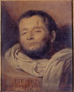 Conspirator Prints: Head of Giuseppe Fieschi (1790-1836)