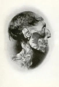 New Kingdom Prints: Head of the mummy of Rameses II