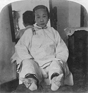 Footbinding Gallery: A high caste ladys dainty lily feet, showing method of deformity, China, 1900