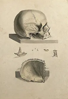 Cross Section Prints: Human skull: six figures showing sections and an entire skull, 1830-1835. Creator: Unknown
