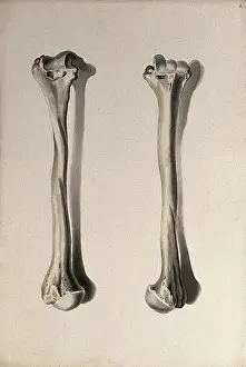 Cheselden William Prints: Humerus bone: two figures, 1830-1835. Creator: Unknown