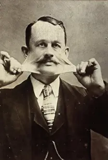 Medical Prints: James Morris, stretching the skin on his face. Creator: Unknown