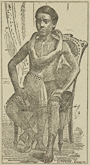 Variety Act Prints: Lalloo, The Greatest Living Wonder on Earth, 1887. Creator: Unknown