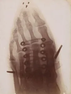 Toes Prints: Le pied a travers la chaussure, 1896. Creator: Henri van Heurck