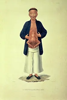 Deformed Prints: L'heteradelphe Ake, c1824-c1826