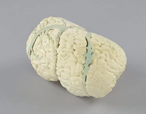 Model of the conjoined brains of Ladan and Laleh Bijani used by Dr. Ben Carson, 2003