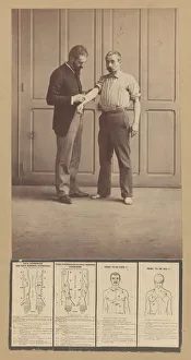 Diagrams Prints: Notation of Scars, Schematic Drawings, ca. 1893. Creator: Alphonse Bertillon