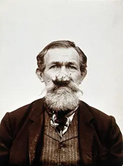 A patient of Leon Desguin, before operation, c1890s. Creator: Unknown