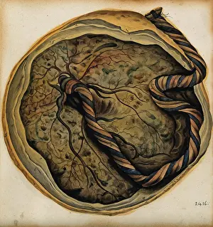Birth Prints: The placenta and umbilical cord, 1800-1860. Creator: John Lizars
