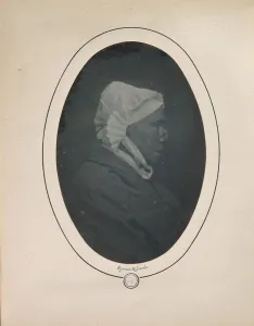 Bisson Louis Auguste Prints: [Profile of a Woman with Necrosis of the Nose], 1841-48. Creator: Louis-Auguste Bisson