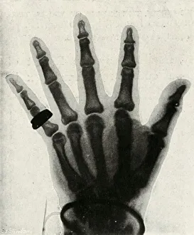 Maxwell Prints: Radiograph of the Hand of H. R. H. The Prince of Wales, (c1897)