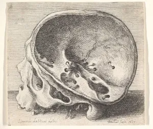 Sectioned skull in profile to left with the left side of the cranium removed, 1651
