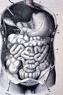 Apparatus Prints: Segments of the colon seen together after resection of the anterior wall of the abdomen and thorax