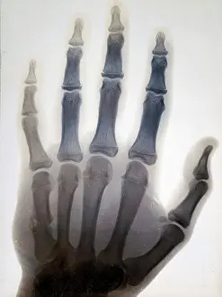 1896 Prints: Sir Gervas Powell Glyn, 6th Bart: radiograph of his hand, 1896. Creator: Sir GP Glyn