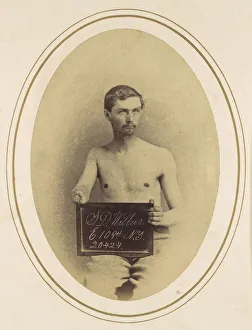 Amputation Prints: Stephen D. Wilbur, 1865. Creator: Reed Brockway Bontecou