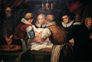 Operating Theatre Prints: Surgeons performing an operation on a woman's breast in the seventeenth century