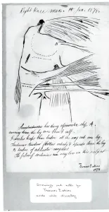 Eakins Thomas Prints: (Untitled) (Anatomical Study Of Right Knee), 1878. Creator: Thomas Eakins