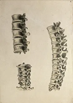 Cheselden William Prints: Vertebrae: three figures, 1830-1835. Creator: Unknown