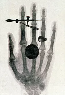 Bone Collection: Wilhelm Roentgens X-ray photograph of his wifes hand, 1896. Artist: Wilhelm Conrad Rontgen