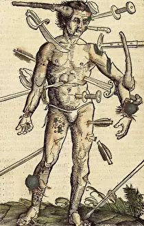 The wound man, 1517. Creator: Hans Wechtlin the Elder