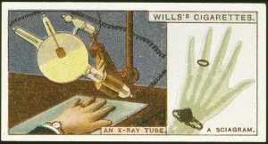 Radiation Prints: X-raying the hand, 1924